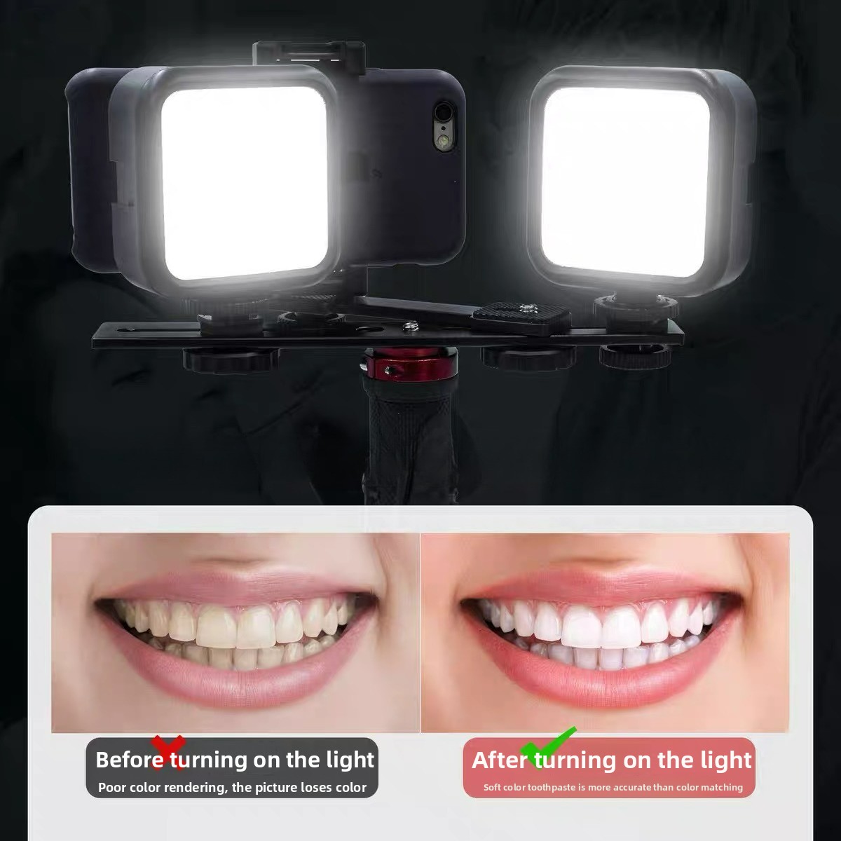 Стоматологический светильник д – обзор и цена Photography Mobile Lighting
